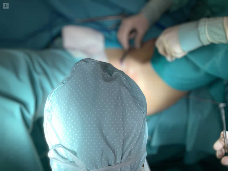 Vaginoplastía