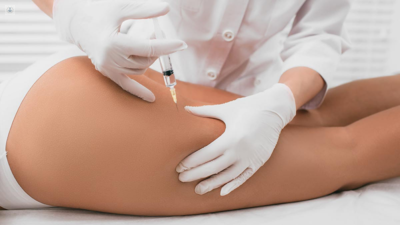 Mesoterapia