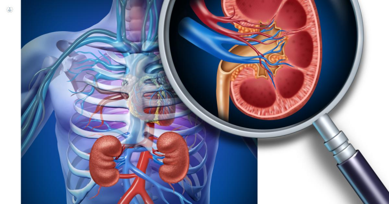 Insuficiencia Renal