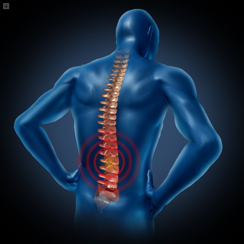 Lesión de la Médula Espinal