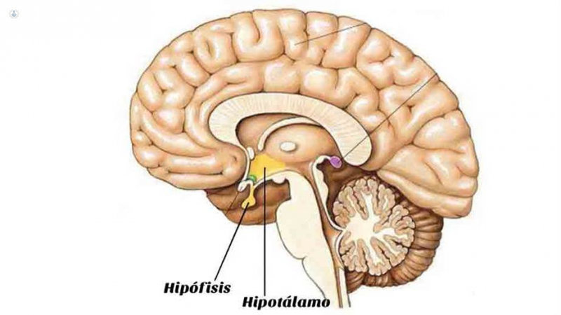 Enfermedades de la Hipófisis y del Hipotálamo